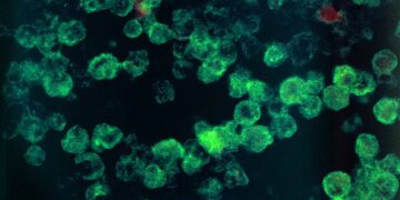 Naegleria fowleri se encuentra como una de las amebas más peligrosas para el ser humano (Foto: Getty Images/Referencial)