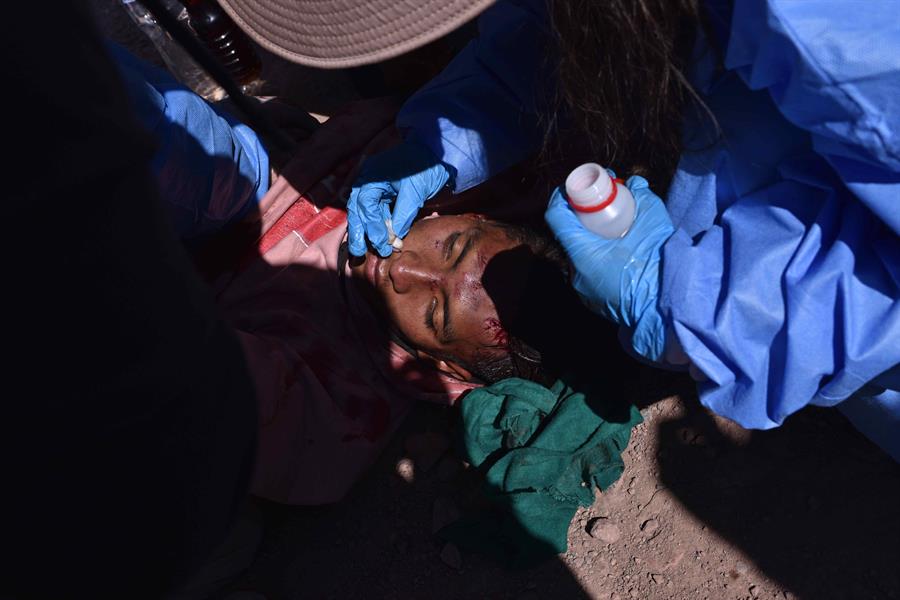 Un herido durante los enfrentamientos entre manifestantes y la policía fue registrado este lunes, 9 de enero, al ser atendido, en Juliaca (Perú). EFE/Stringer