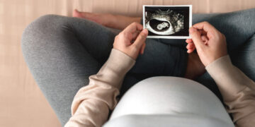 Una embarazada observando una foto de un feto Getty Images/EyeEm